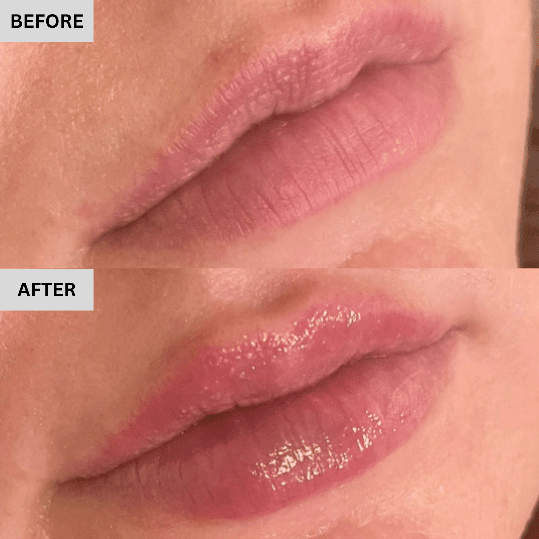 Lipful™ Hyaluronic Lip Plumper