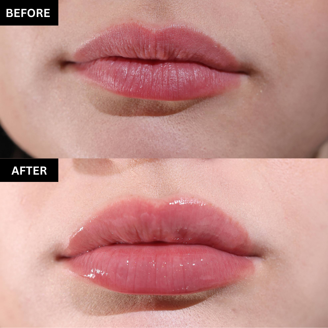 Lipful™ Extreme Lip Plumper
