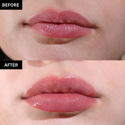 Lipful™ Extreme Lip Plumper